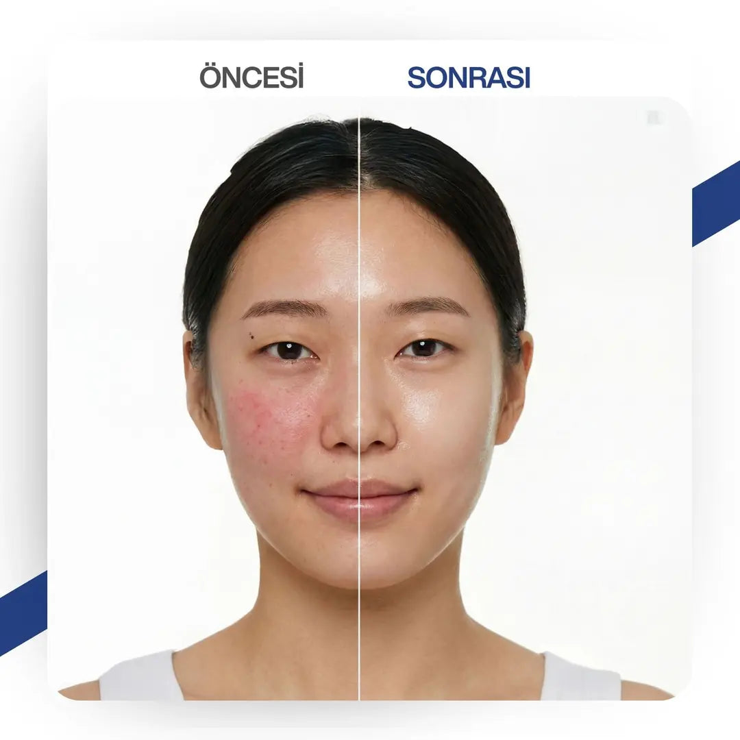 The Cell Lab Kızarıklık ve Hassasiyet Karşıtı Yatıştırıcı & Nemlendirici Yüz Maskesi (7°C SOOTHING) 5 ADET