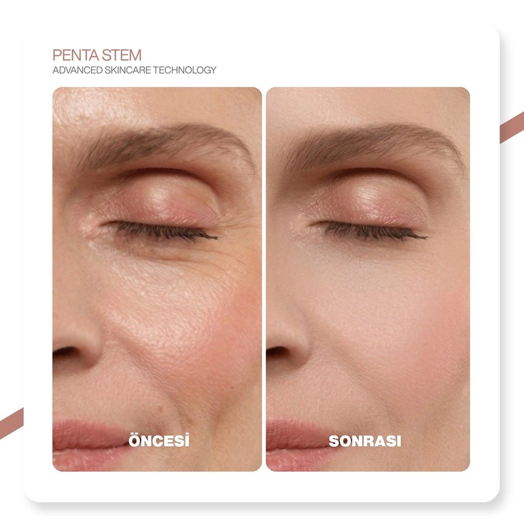 PDRN +Hücre Teknolojisi | Bariyer Onarıcı | Kırışıklık Karşıtı|Beyazlatıcı &Nemlendirici Esans 50ml