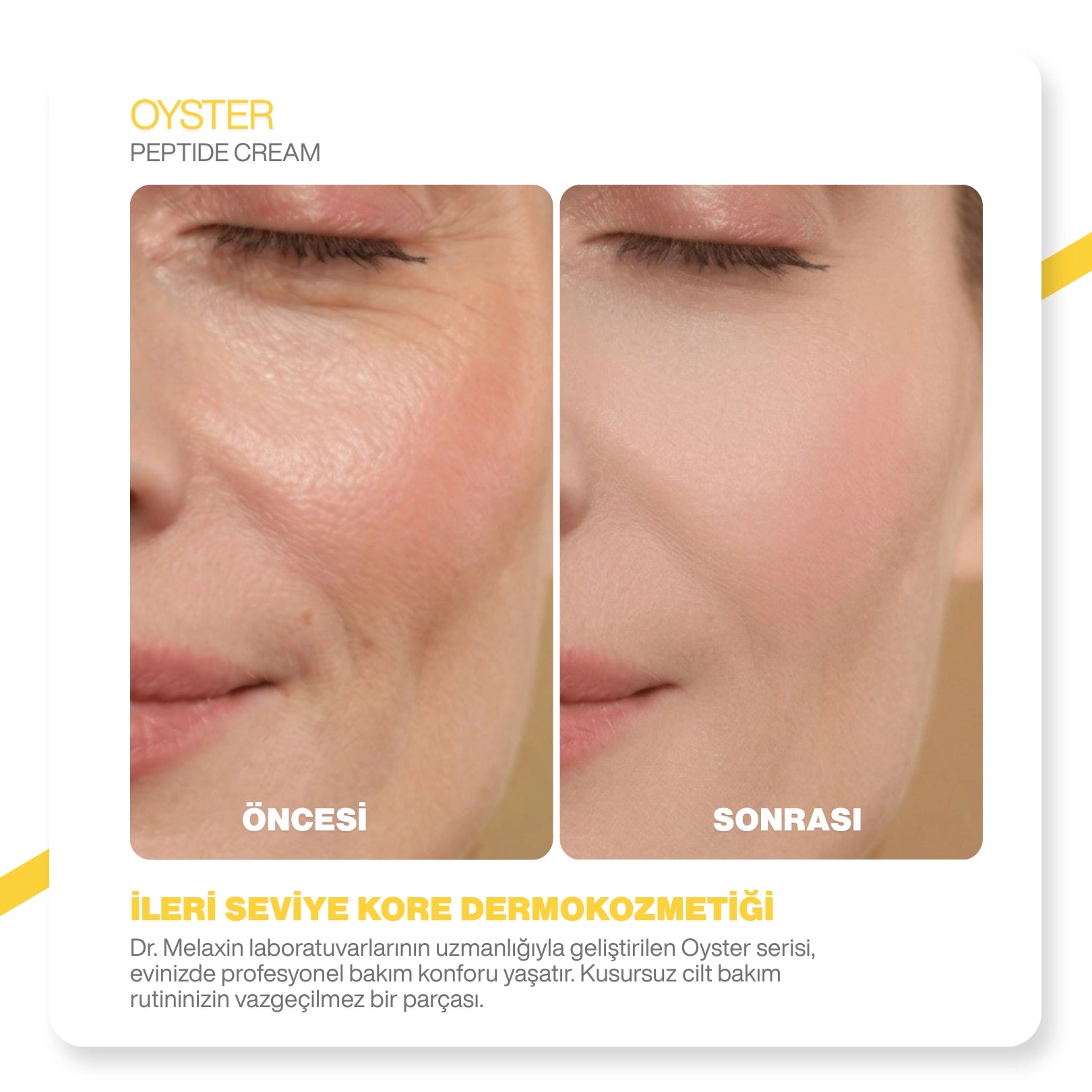 Dr.Melaxin Oyster Yaşlanma Karşıtı | Sıkılaştırıcı | İstiridye Özlü | Anti-Aging Yüz Kremi 50ml
