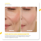 Dr.Melaxin Oyster Yaşlanma Karşıtı | Sıkılaştırıcı | İstiridye Özlü | Anti-Aging Yüz Serumu 30ml