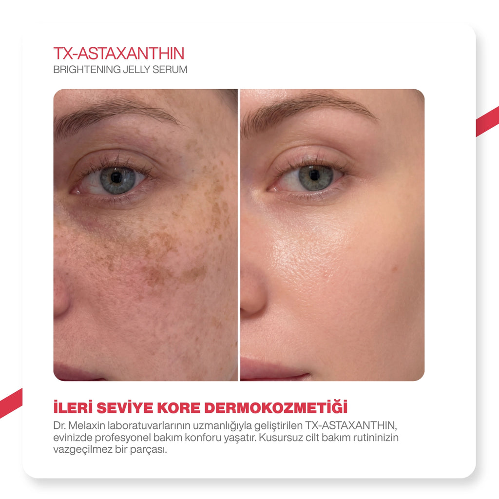 Dr.Melaxin Leke Karşıtı Jel Serum | Tranexamic + Astaxanthin + Niacinamide | 3 Etki Tek Formül 30ml