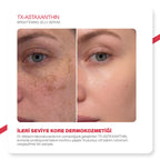 Dr.Melaxin Leke Karşıtı Jel Serum | Tranexamic + Astaxanthin + Niacinamide | 3 Etki Tek Formül 30ml