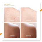 Dr.Melaxin Kojik Asit İçerikli Vücut Peeling Spreyi – Batık ve Kararma Karşıtı Bakım 200ml