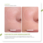 Cactox Gözenek Sıkılaştırıcı | Siyah Nokta Karşıtı | Arındırıcı Kaktüs Özlü Esans Yüz Toniği 150ml