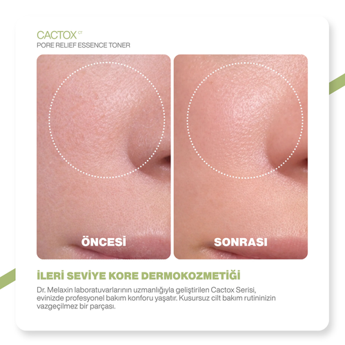 Cactox Gözenek Sıkılaştırıcı | Siyah Nokta Karşıtı | Arındırıcı Kaktüs Özlü Esans Yüz Toniği 150ml
