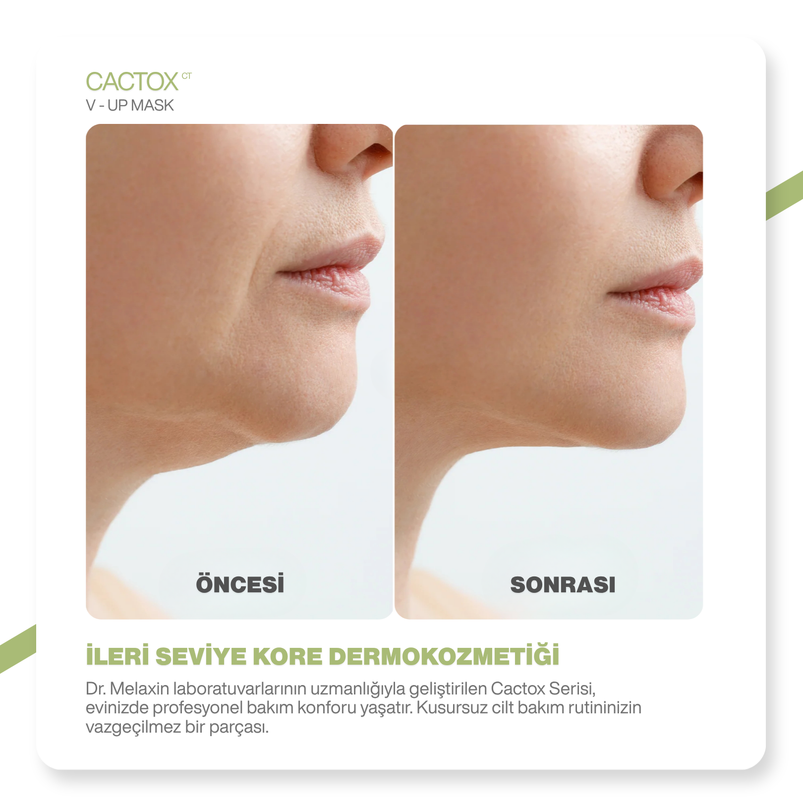 Cactox Yüz Şekillendirici | Gıdı Toparlayıcı | Yüz Germe | Çene Toparlayıcı Bakım Bandı 4 ADET