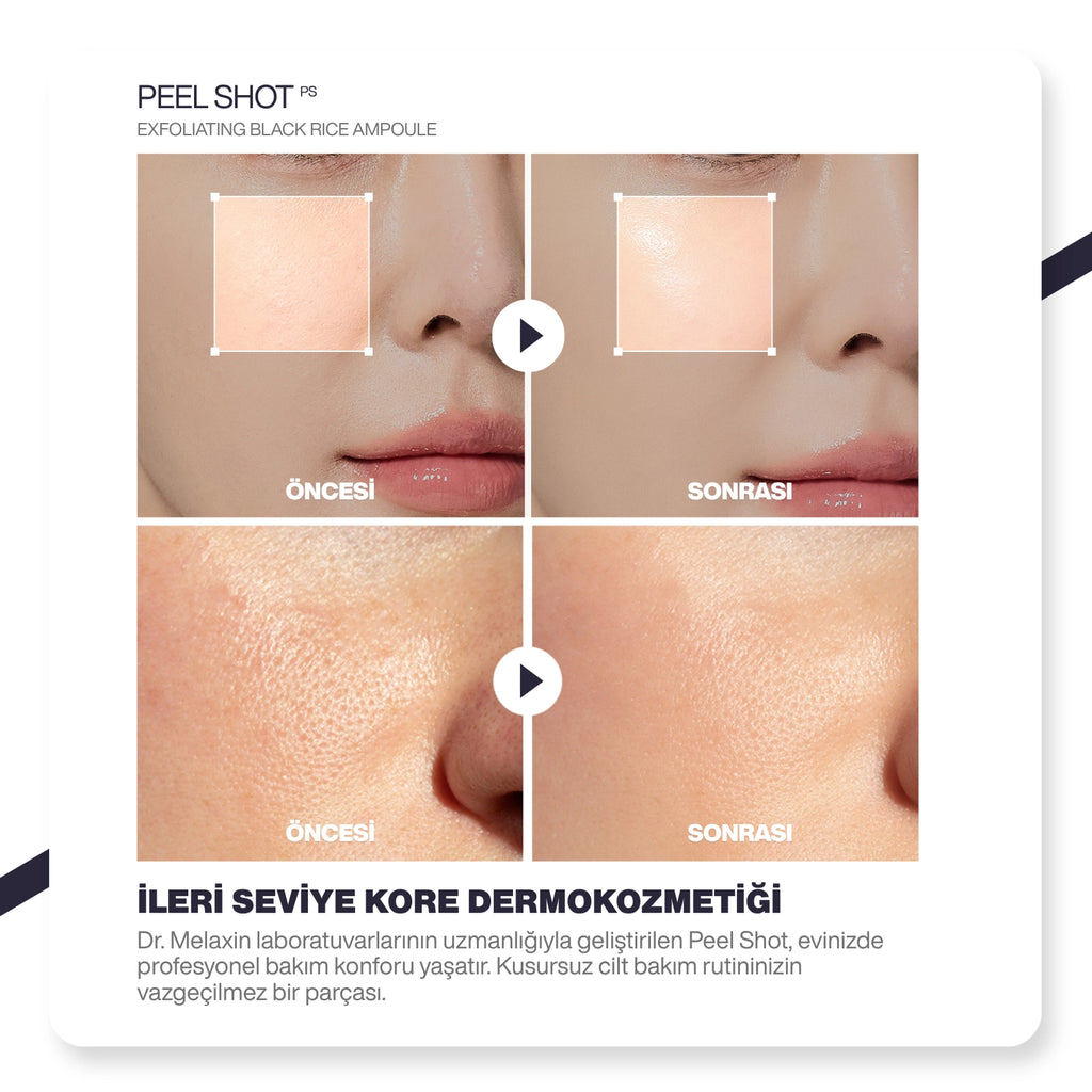 Dr.Melaxin Siyah Pirinç Özlü Gözenek & Siyah Nokta Karşıtı Arındırıcı Peeling Serum 80ml