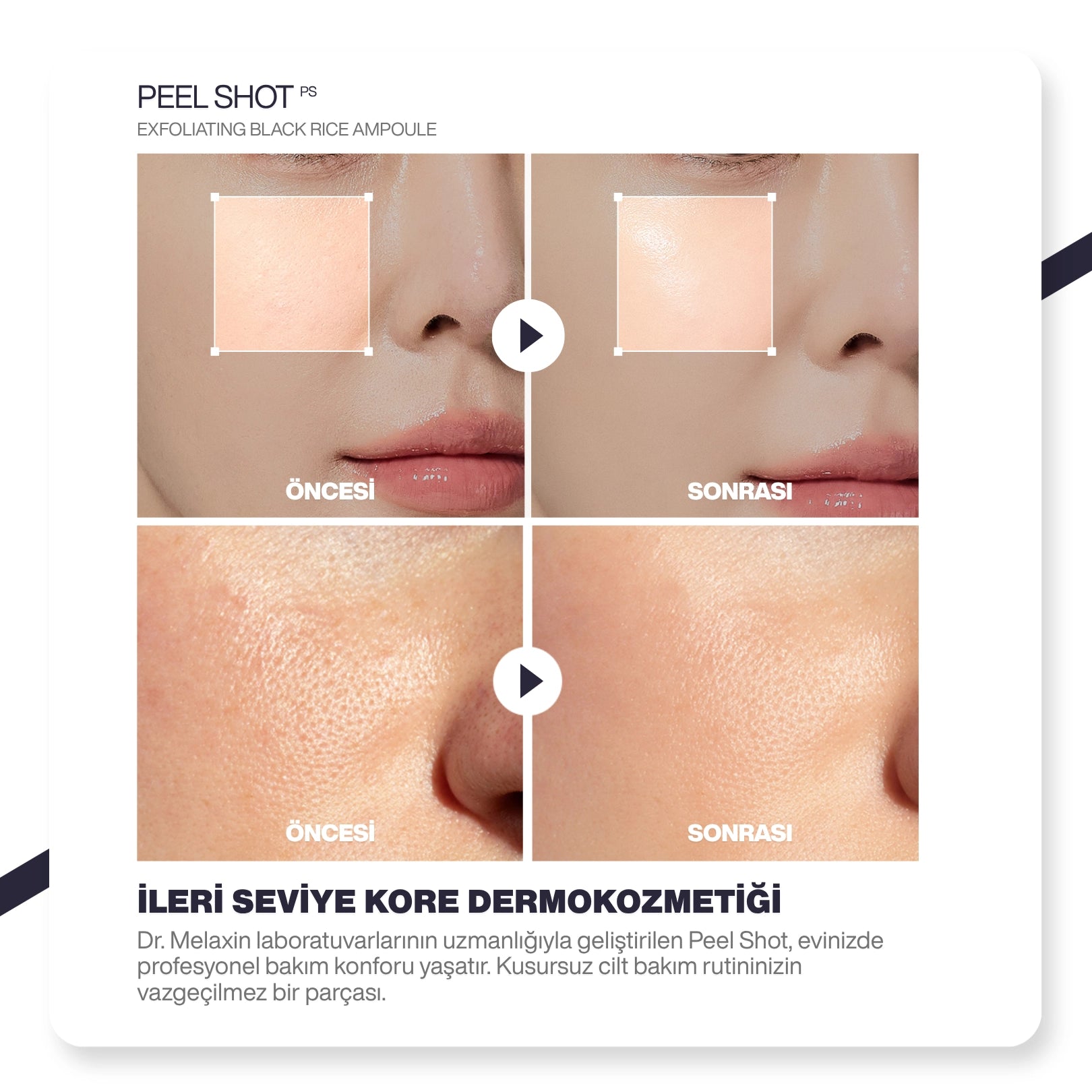 Dr.Melaxin Siyah Pirinç Özlü Gözenek & Siyah Nokta Karşıtı Arındırıcı Peeling Serum 80ml
