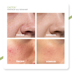 Gözenek Sıkılaştırıcı | Kaktüs Özlü | Serinletici Jel Sprey Serum Mist 80 ml