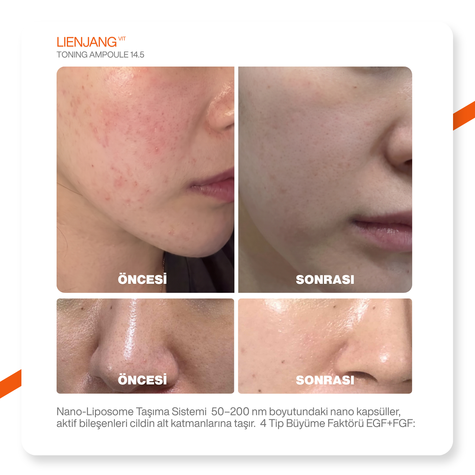 %14.5 Saf C Vitamini & Glutatyon | Leke & Kırışıklık Karşıtı |Yoğun Aydınlatıcı | Ton Eşitleyici Ampül 15 ml