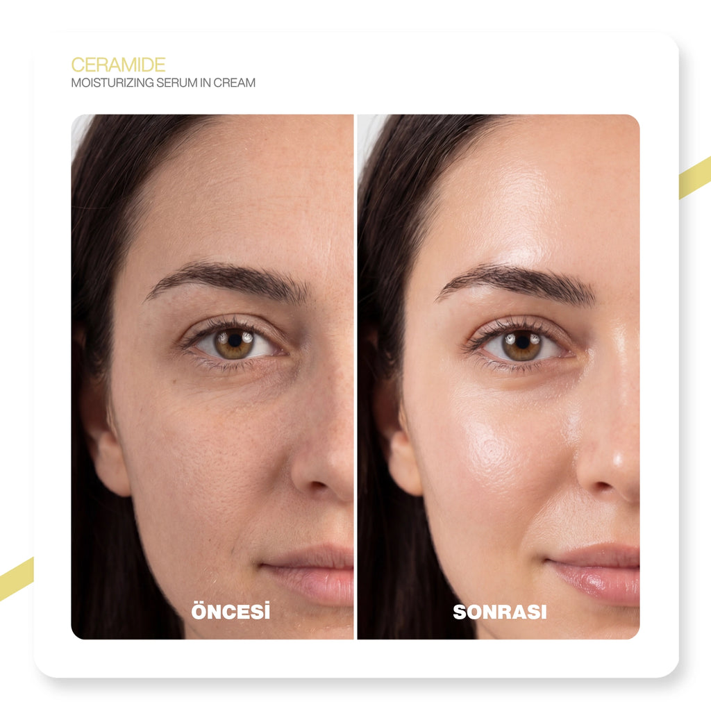 v'anhalla Bariyer Onarıcı Seramid İçerikli Serum Gücüyle Zenginleştirilmiş Yoğun Nemlendirici Yüz Kremi 50ml