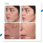 Dr.Melaxin Tx Koyu Leke Karşıtı Aydınlatıcı l Serum 30ml