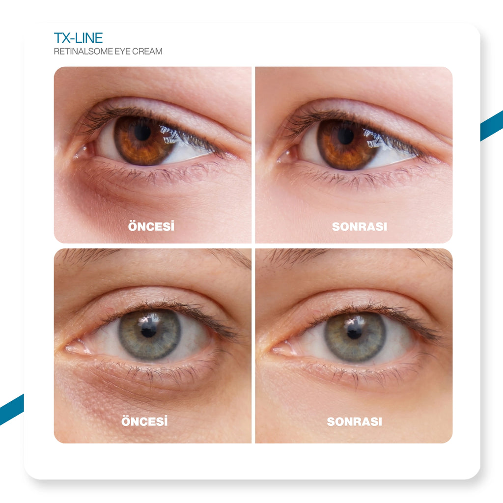Dr.Melaxin TX Retinalsome Çift Etkili Göz Kremi - Kırışıklık ve Morluk Karşıtı Aydınlatıcı Bakım 40gr