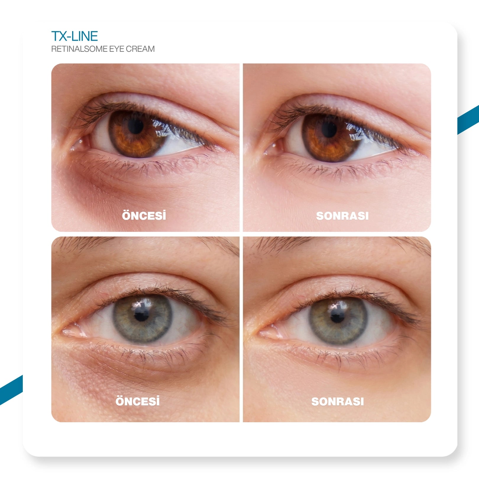 Dr.Melaxin TX Retinalsome Çift Etkili Göz Kremi - Kırışıklık ve Morluk Karşıtı Aydınlatıcı Bakım 40gr
