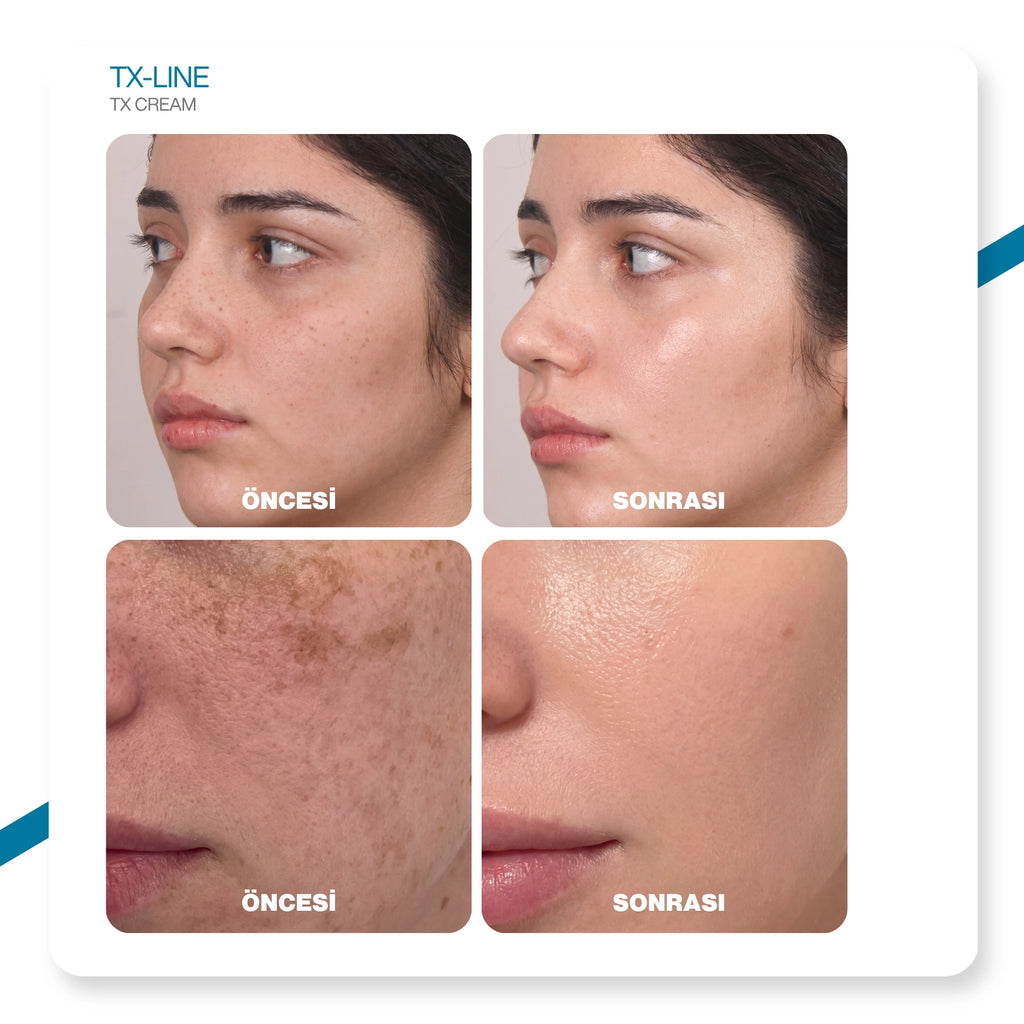 Dr.Melaxin TX Leke Karşıtı Yüz Kremi – Traneksamik Asit & Niasinamid İçerikli 50ml