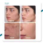 Dr.Melaxin TX Leke Karşıtı Yüz Kremi – Traneksamik Asit & Niasinamid İçerikli 50ml