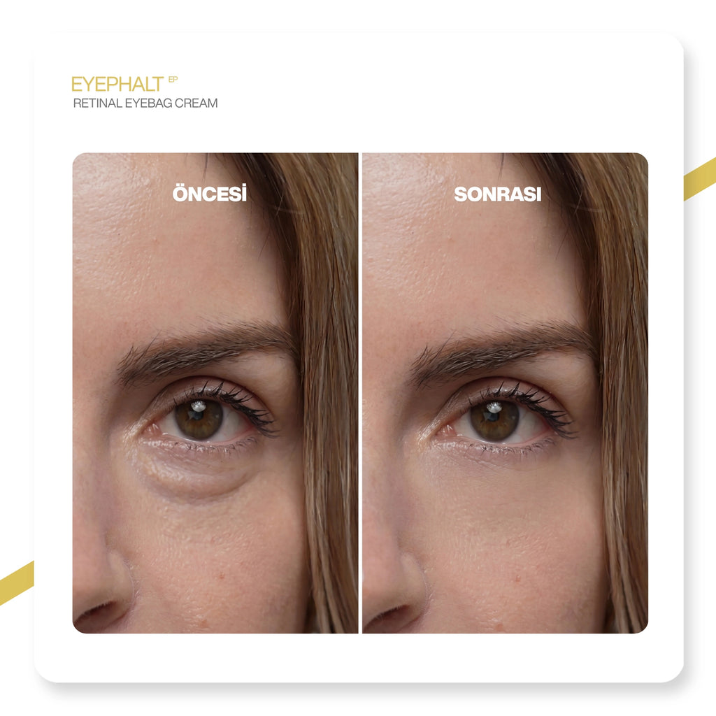 Dr.Melaxin Eyephalt Retinollü Göz Altı Bakım Kremi Bio-Spicule Teknolojili 10ml