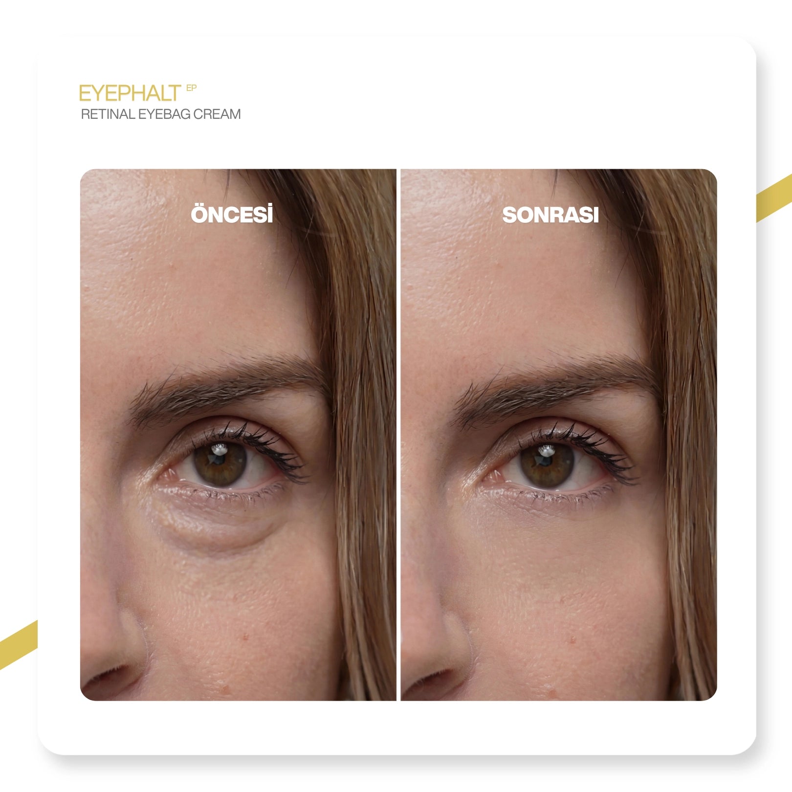 Dr.Melaxin Eyephalt Retinollü Göz Altı Bakım Kremi Bio-Spicule Teknolojili 10ml