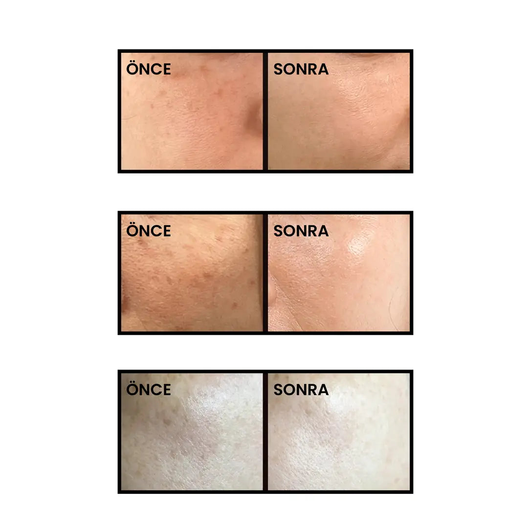 Dr.Melaxin Leke Karşıtı Kapsül Krem – Astaxanthin Içerikli, Cilt Tonu Eşitleyici Aydınlatıcı Bakım 50ml