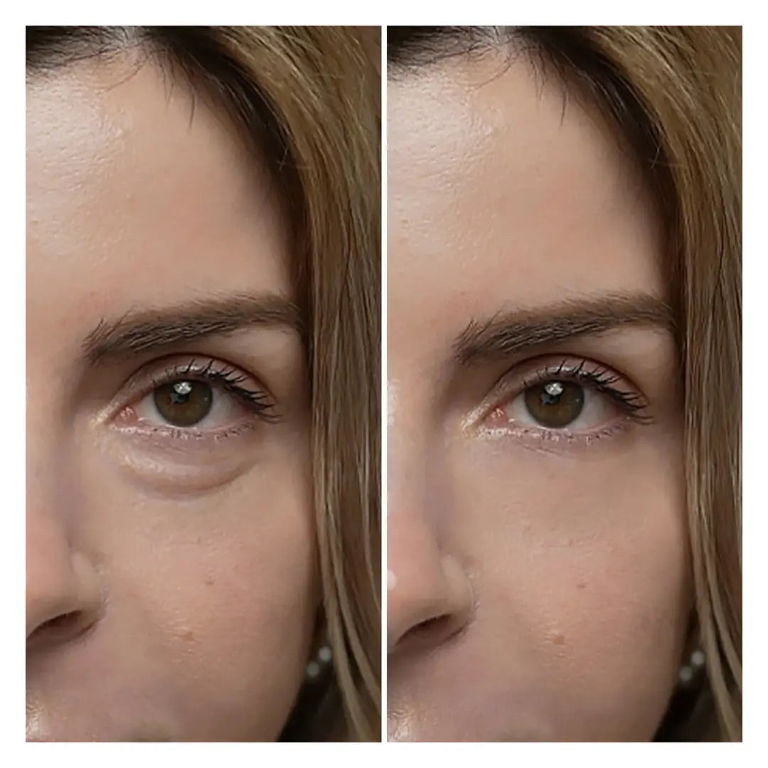 Dr.Melaxin Eyephalt Retinollü Göz Altı Bakım Kremi Bio-Spicule Teknolojili 10ml