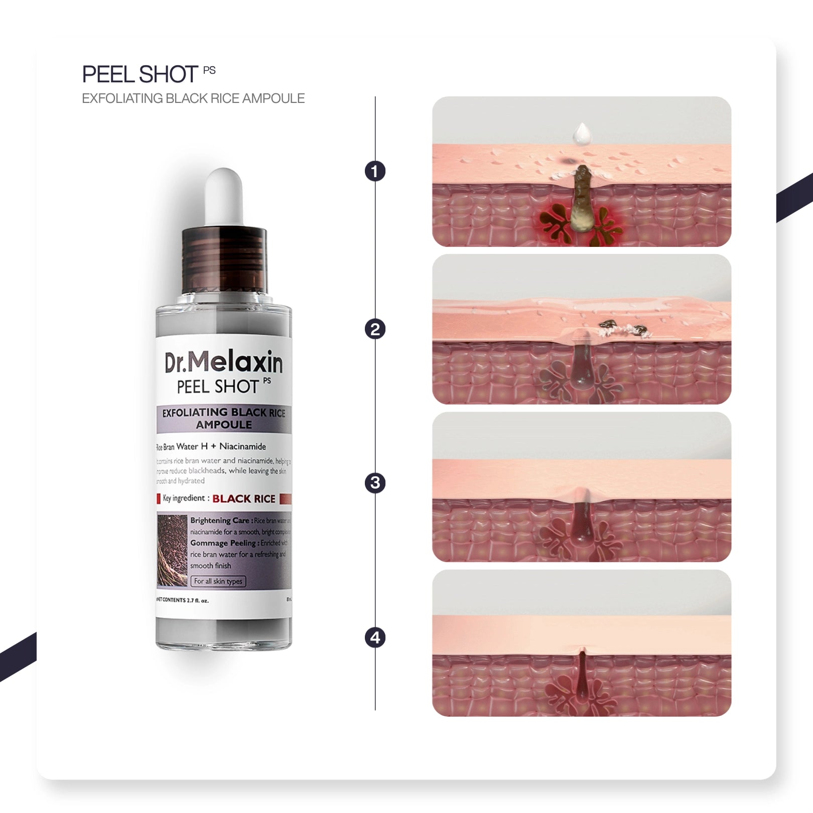 Dr.Melaxin Siyah Pirinç Özlü Gözenek & Siyah Nokta Karşıtı Arındırıcı Peeling Serum 80ml