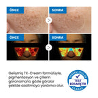 Dr.Melaxin TX Leke Karşıtı Yüz Kremi – Traneksamik Asit & Niasinamid İçerikli 50ml