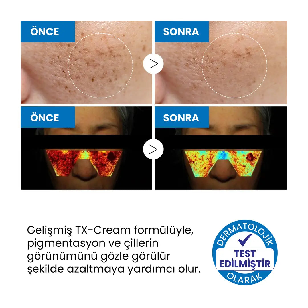 Dr.Melaxin TX Leke Karşıtı Yüz Kremi – Traneksamik Asit & Niasinamid İçerikli 50ml