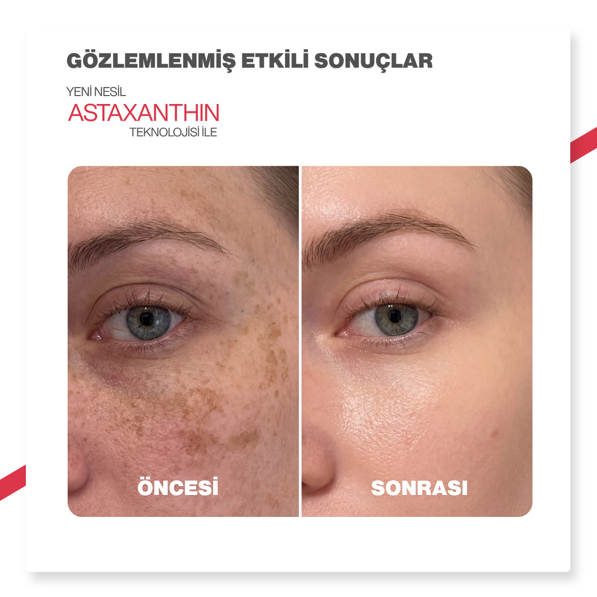 Dr.Melaxin Leke Karşıtı | Aydınlatıcı | Onarıcı| Astaxanthin içeren Soyulabilen Gece Maskesi | 80ml
