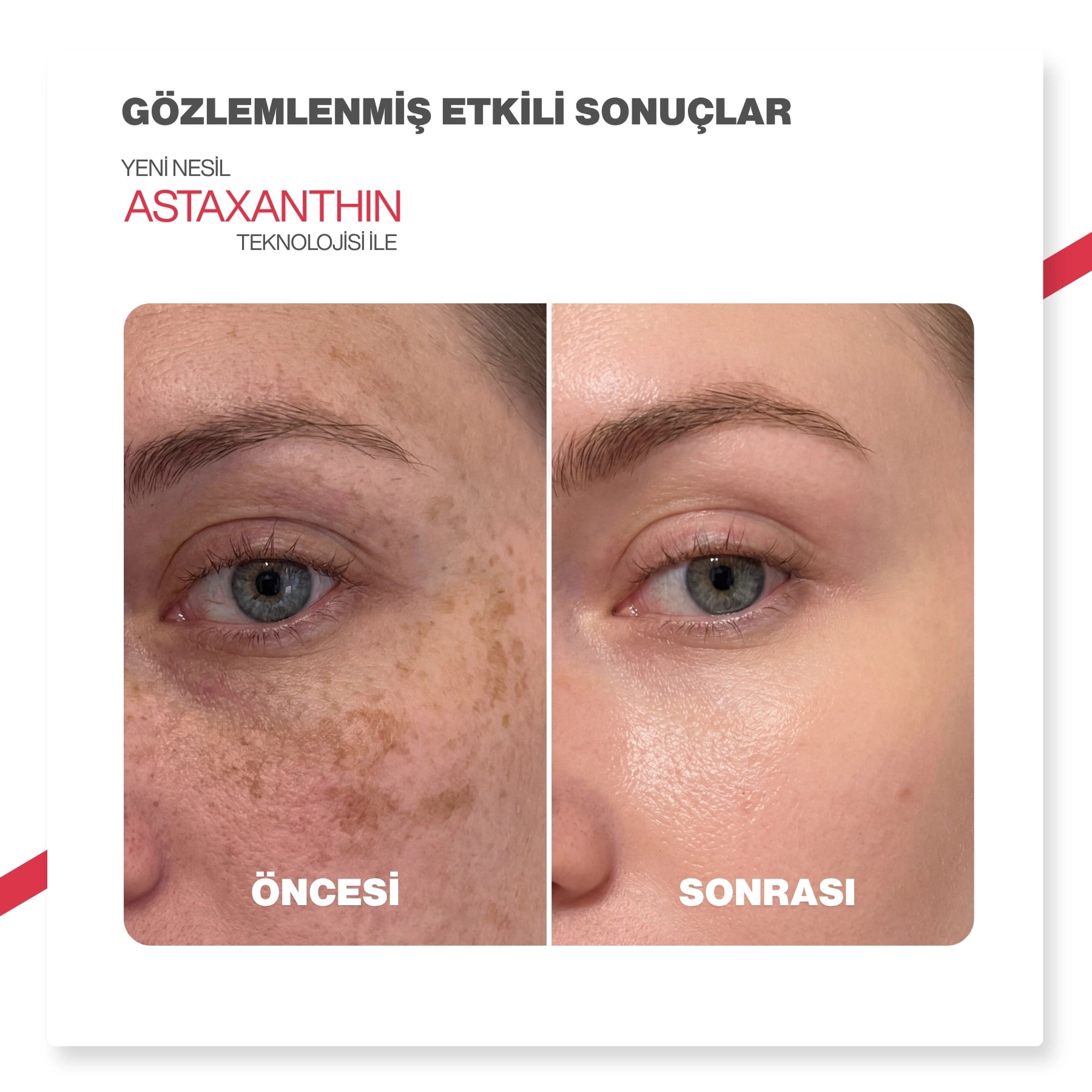 Dr.Melaxin Leke Karşıtı Kapsül Krem – Astaxanthin Içerikli, Cilt Tonu Eşitleyici Aydınlatıcı Bakım 50ml