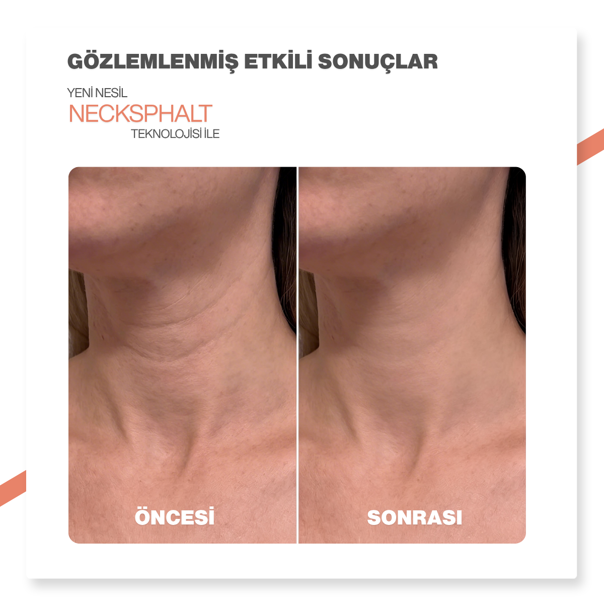 Dr.Melaxin Kırışıklık Karşıtı | Sıkılaştırıcı | Lifting Etkili | Bariyer Onarıcı Boyun Kremi 50 ml