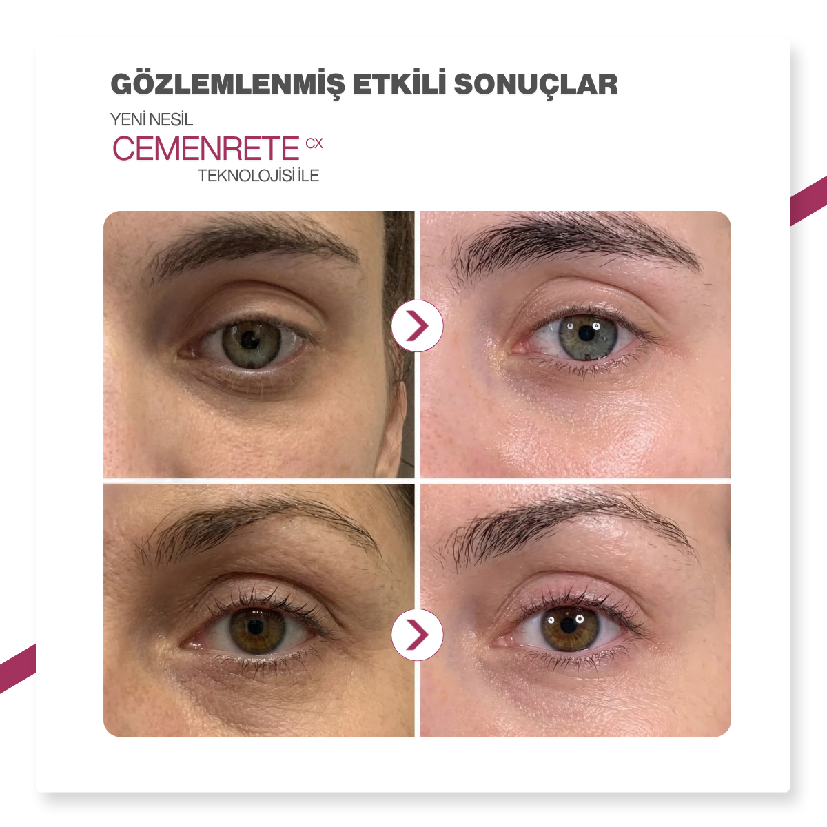 Dr.Melaxin Cemenrete Sıkılaştırıcı & Kırışıklık Karşıtı Ampül
