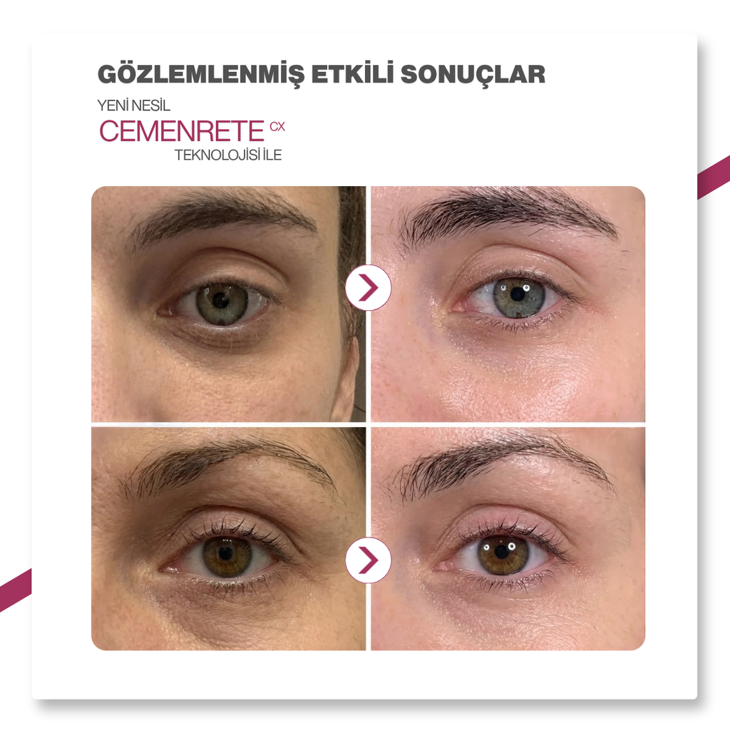 Dr.Melaxin Kırışıklık Karşıtı & Sıkılaştırıcı Rebornic Teknolojili Kalsiyum | Yüz & Göz Çevresi Kremi 50ml