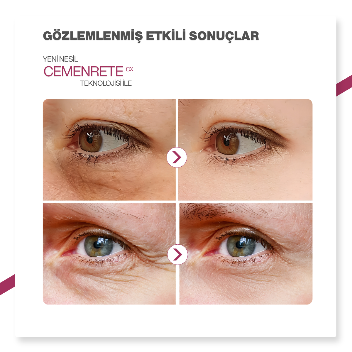 Dr.Melaxin Cemenrete Kalsiyumlu Göz Altı Pedi 60 Adet